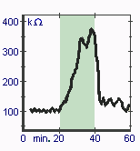 Experimental curve showing dramatic increase in galvanic skin resistance during the practice of NSR